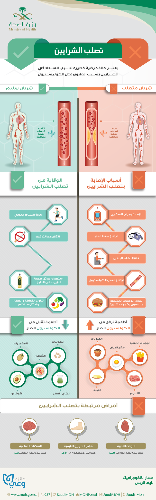 الأمراض المزمنة - أمراض القلب و الأوعية و الشرايين